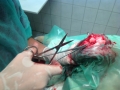 Elülső keresztezőszalag szakadás műtét